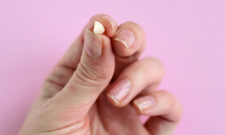 Түсінде тіс түссе / Бұл нені білдіреді ?