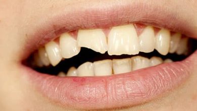 түсінде тісің сынса не болады