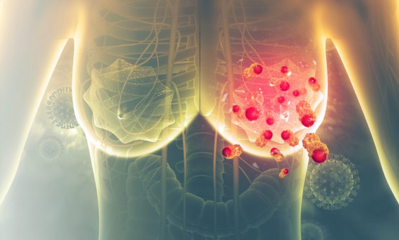 емшектегі түйінді қалай кетіруге болады